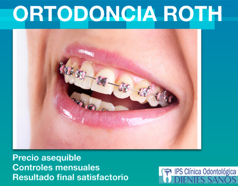 Ortodoncia-brackets-alinear-dientes-medellin-roth.png