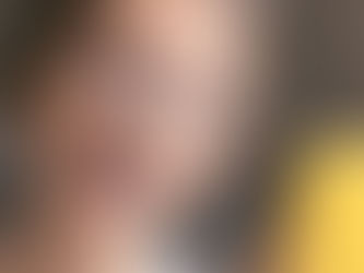 Sinais de que seu filho pode precisar de aparelho ortodôntico