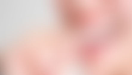 Porque escolher os alinhadores para corrigir meus dentes?