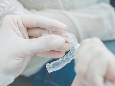 Tudo sobre o Clareamento Dental