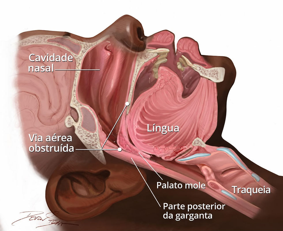 Sintomas de apneia do sono