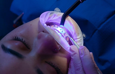 Clareamento dental Florianópolis