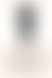 Top 5 Sunscreens for Hyperpigmentation and Dark Spots (2026 Guide)