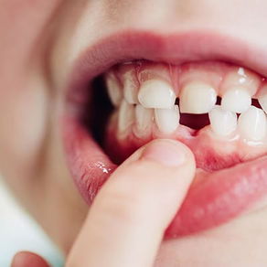 Losing Baby Teeth: What Parents Should Know