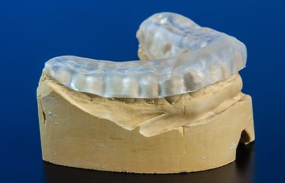 Castle Lake Dental of Lewisville & Carrollton, TX 75056 Cosmetic, Veneers, Family, Emergency - Special Needs Dentistry, Kid Friendly Dentist, Dental Implants, Sedation, Wisdom Tooth Extraction, Crowns, Bridges, Porcelain Veneers, Bioclear, Suresmile, Teeth Whitening, Esthetic Filling, Tooth Bonding, Cleaning, Dental Checkup, Periodontal Therapy, Nightgurads, Sleep Apnea
