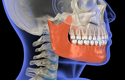 Castle Lake Dental of Lewisville & Carrollton, TX 75056 Cosmetic, Veneers, Family, Emergency - Special Needs Dentistry, Kid Friendly Dentist, Dental Implants, Sedation, Wisdom Tooth Extraction, Crowns, Bridges, Porcelain Veneers, Bioclear, Suresmile, Teeth Whitening, Esthetic Filling, Tooth Bonding, Cleaning, Dental Checkup, Periodontal Therapy, Nightgurads, Sleep Apnea
