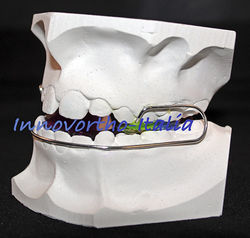 innovortho-italia-Bionator-inverso-sx