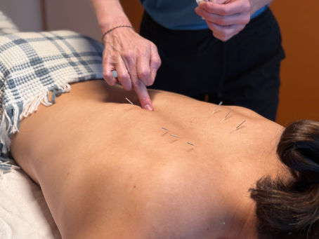TCM und Physiotherapie – warum die Kombination mehr bewirkt als jede Methode allein