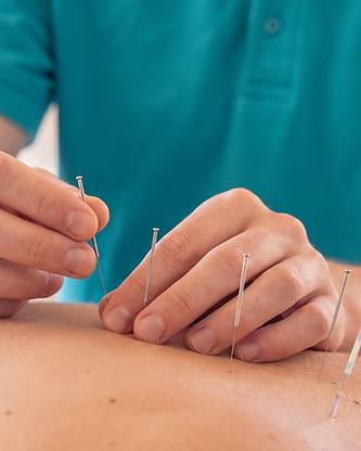 Akupunktur in Basel beim Gesundheitszentrum Basel