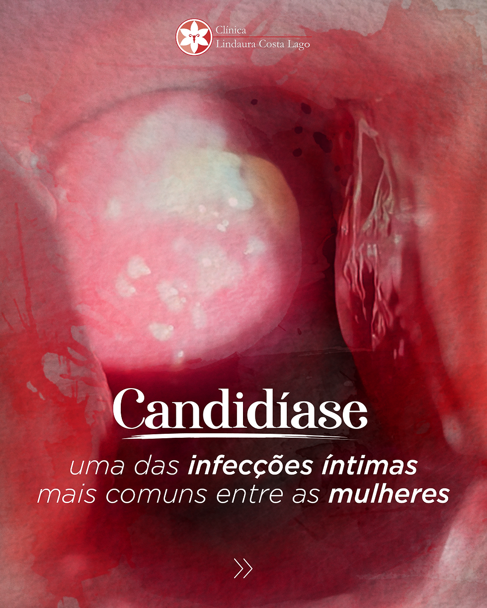 candidíase
