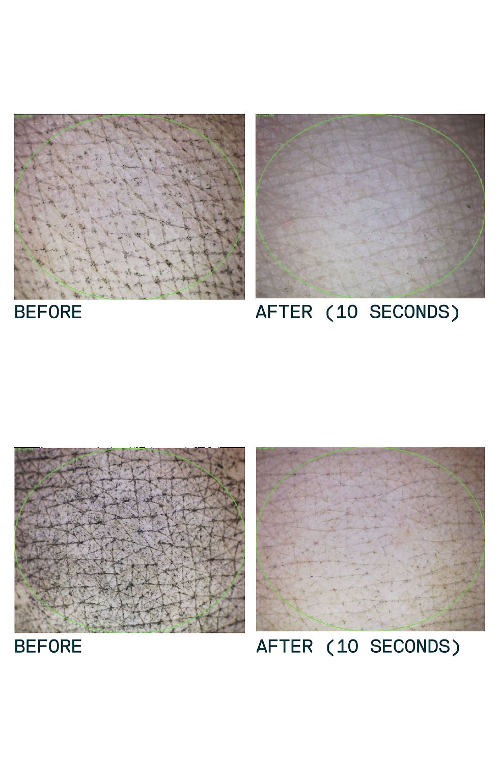 Thumbnail: Moisture-Balance All-In-One Face Cleanser - 150ml