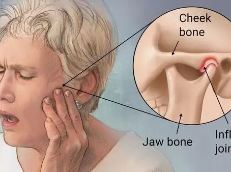 Tratamento para Articulação Temporo-Mandibular (ATM) no Montijo
