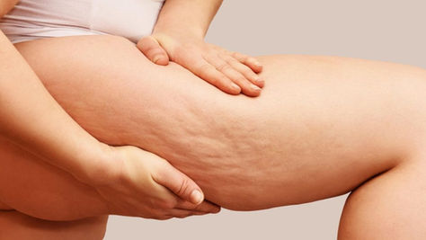 Comment raffermir votre peau et lisser la cellulite sans douleur ?