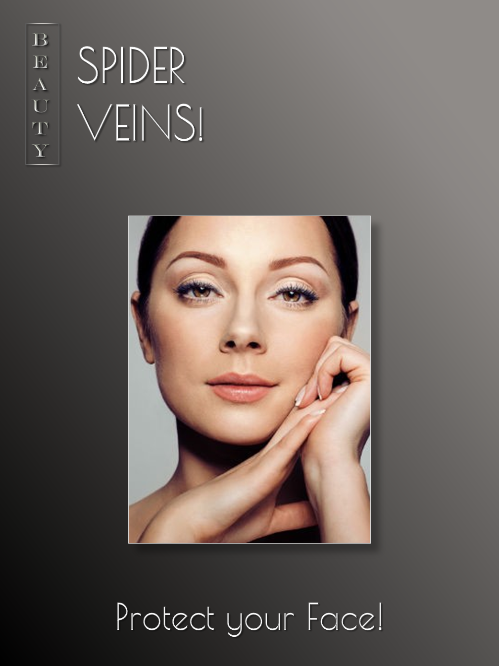 Spider Veins