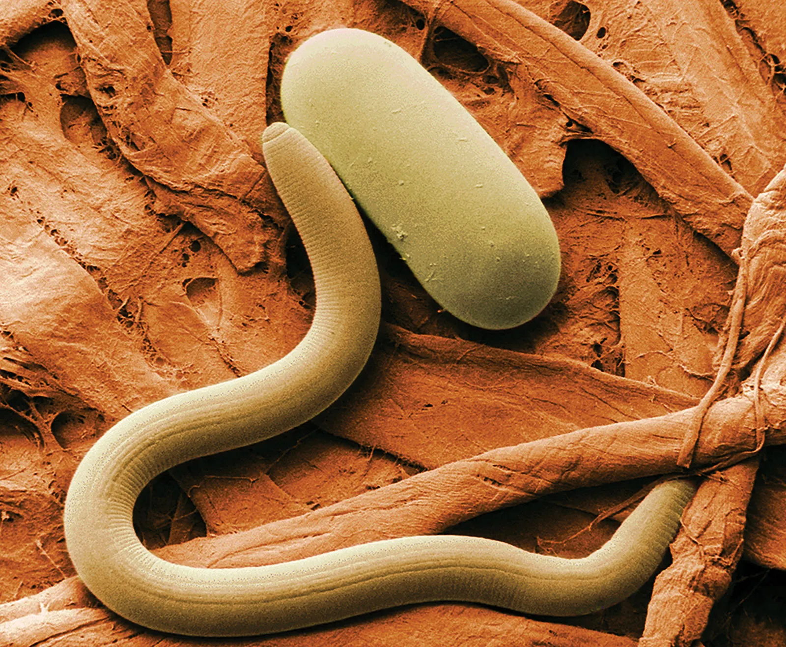 Nematode.webp
