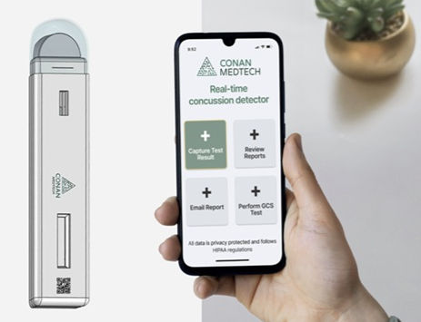 Conan MedTech: Diagnosing Concussions Immediately