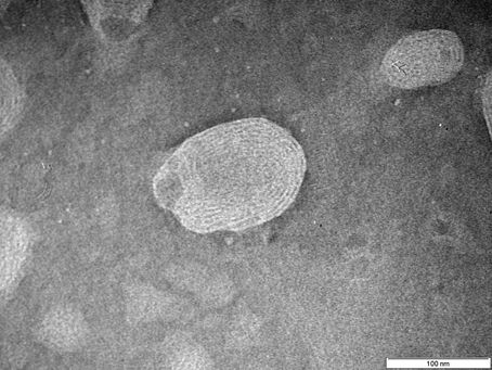 SciTech Advances ST-001 nanoFenretinide to Clinical Trials for SARS-CoV-2