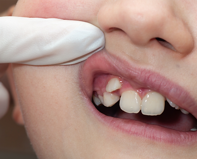 Untitled design_edited.png