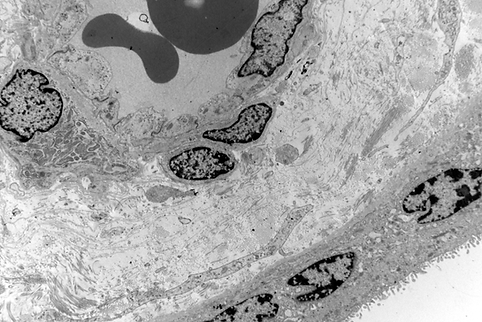 TEM Human Dev 02.png