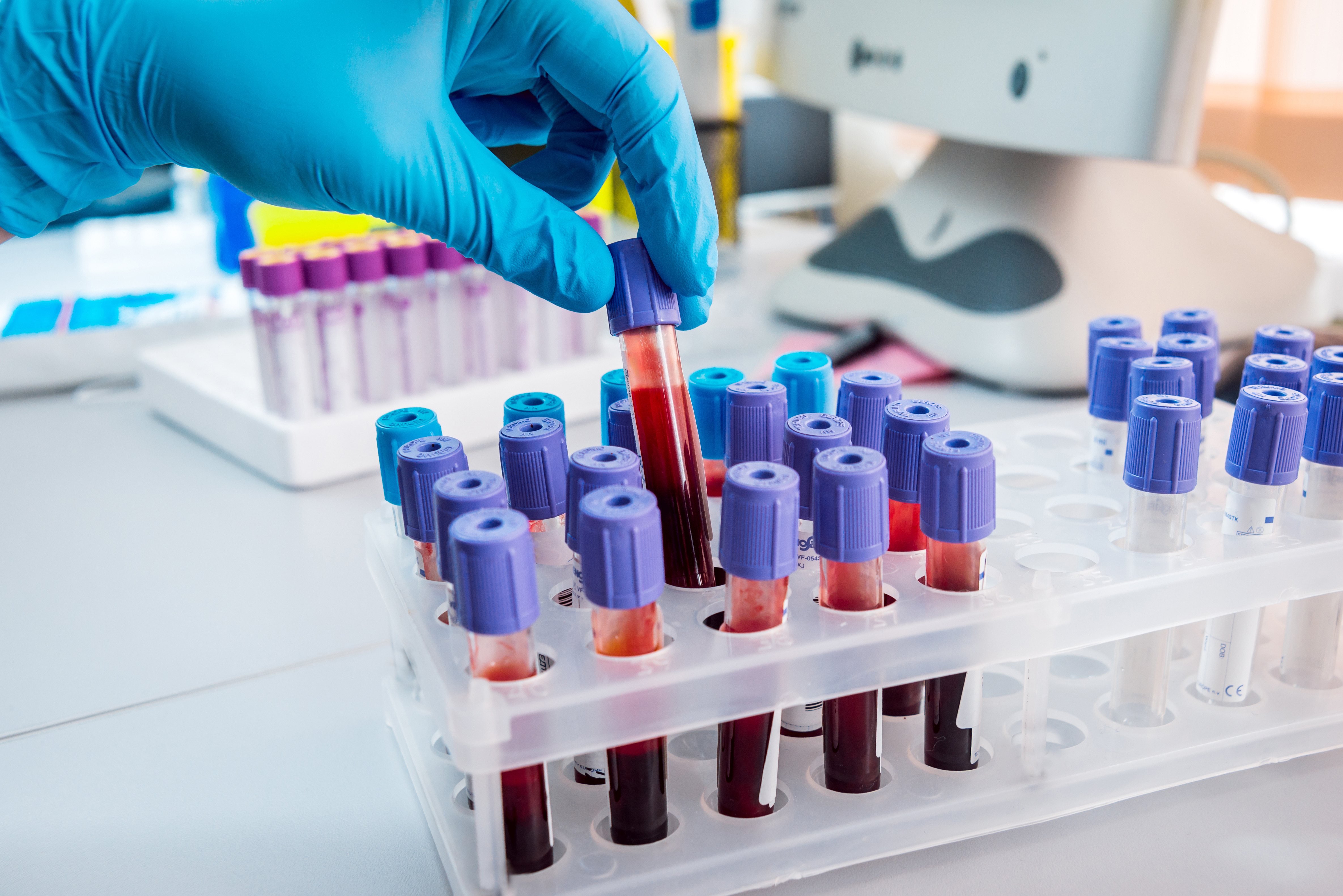 Labador Testing Point of Care Lab Testing | Red Hook Family