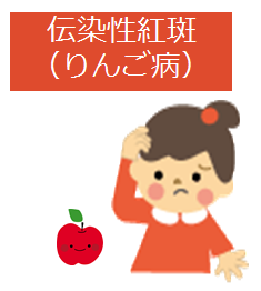 伝染性紅斑 りんご病