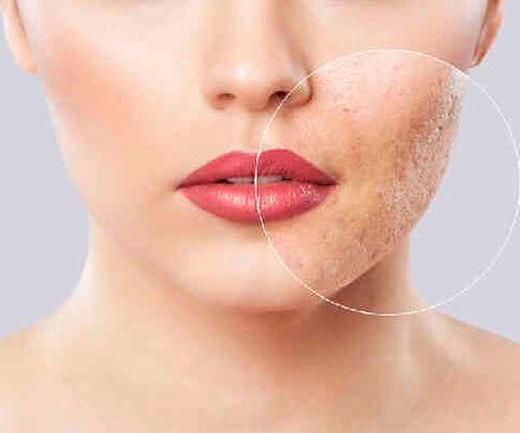 Dermatology