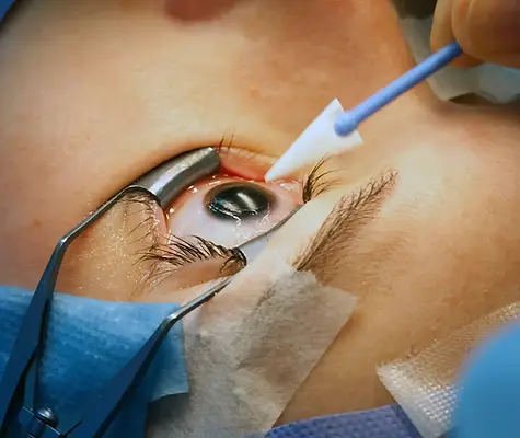 Ophthalmology