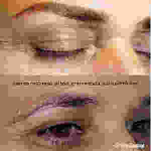 הסרת איפור קבוע - שירה זאבי