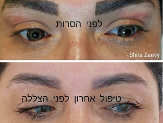 הסרת איפור קבוע - מתי זה נדרש?