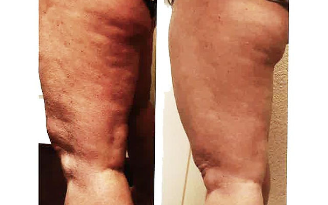 new hope semaglutide New Hope Weight Loss in Costa Mesa, CA – Reviews, Hours, and Contact Details new hope semaglutide New Hope Weight Loss in Costa Mesa, CA – Reviews, Hours, and Contact Details