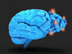 How to Stop Brain Inflammation