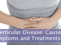 What is Diverticular Disease and What Causes It?