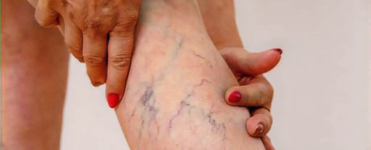 Screenshot 2026-03-30 at 10.37_edited.jp