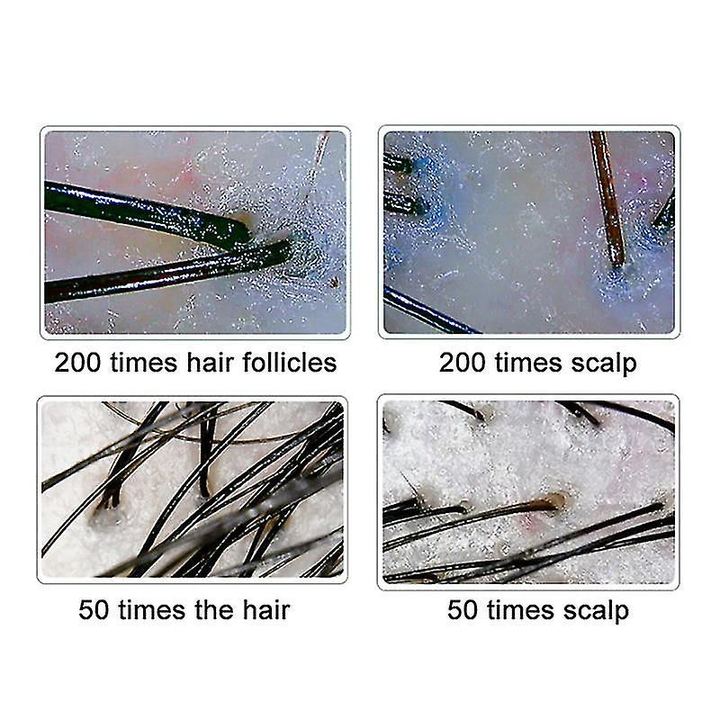 AI Scalp Analysis — 200x Magnification