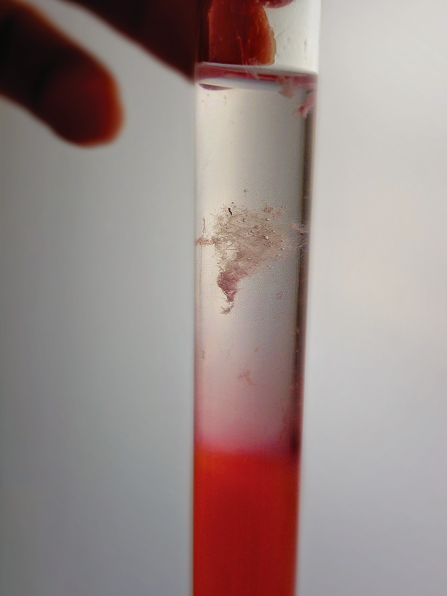 Extracción de ADN
