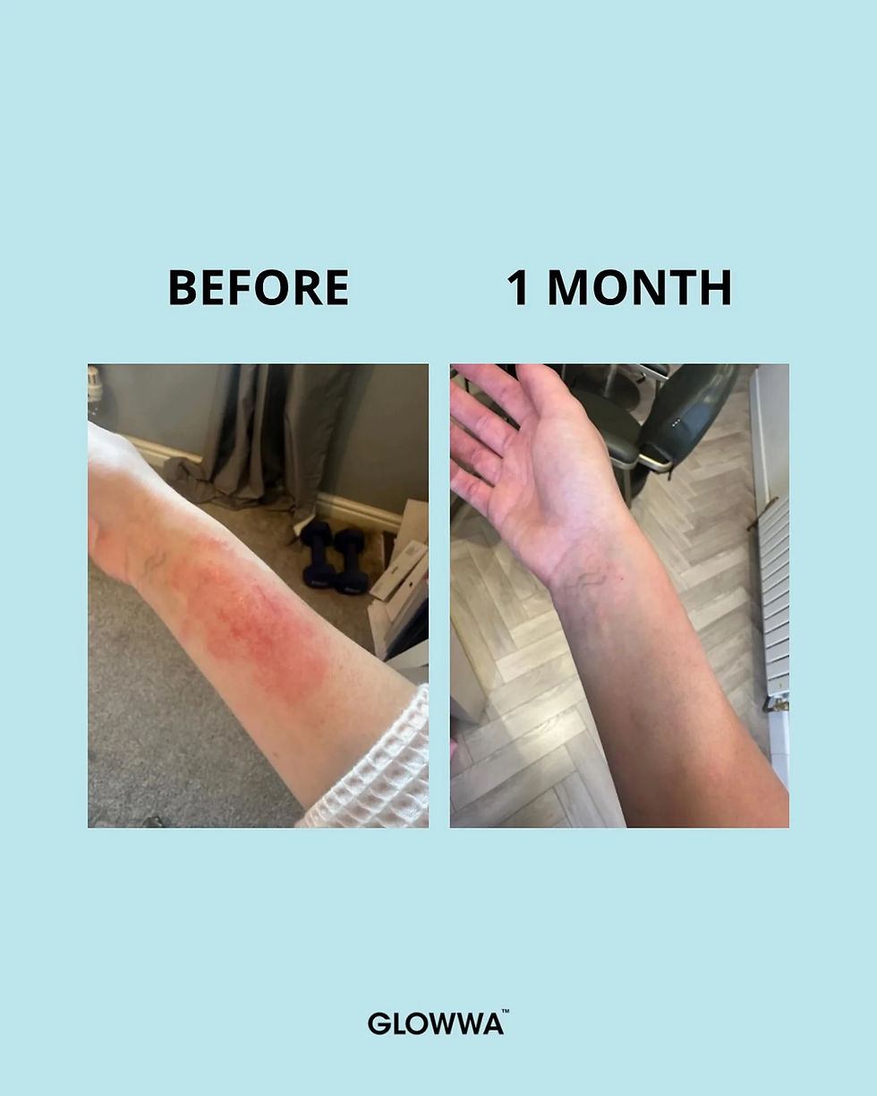 Thumbnail: GLOWWA Collagen Creamer - 15 Day Supply