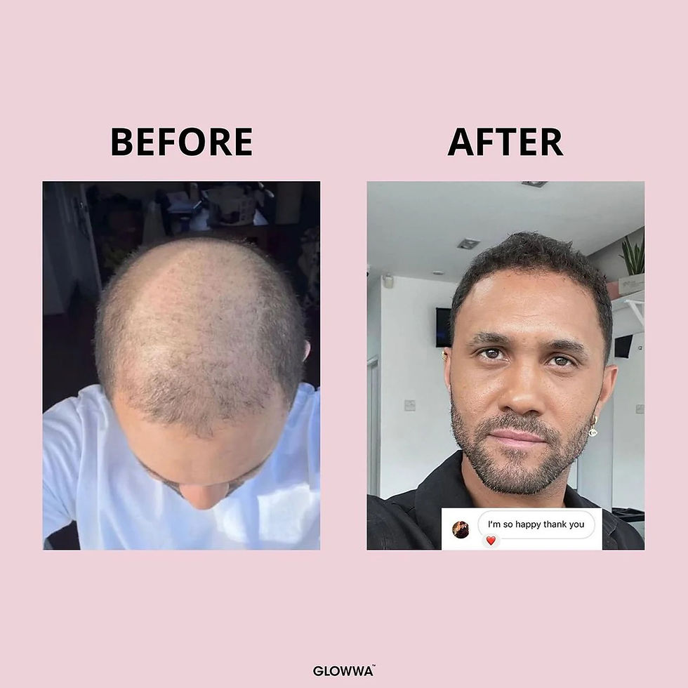 Thumbnail: GLOWWA Hair Food - 3 Month Supply