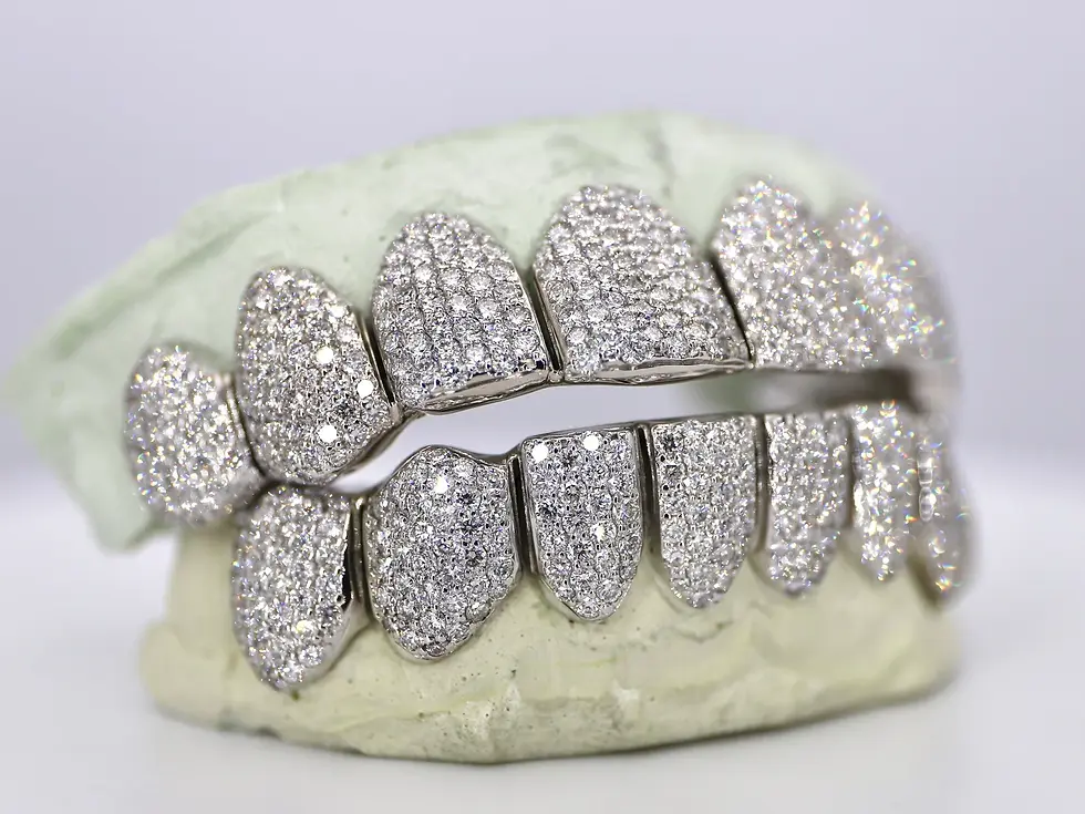 Thumbnail: VVS LAB DIAMOND GRILLZ