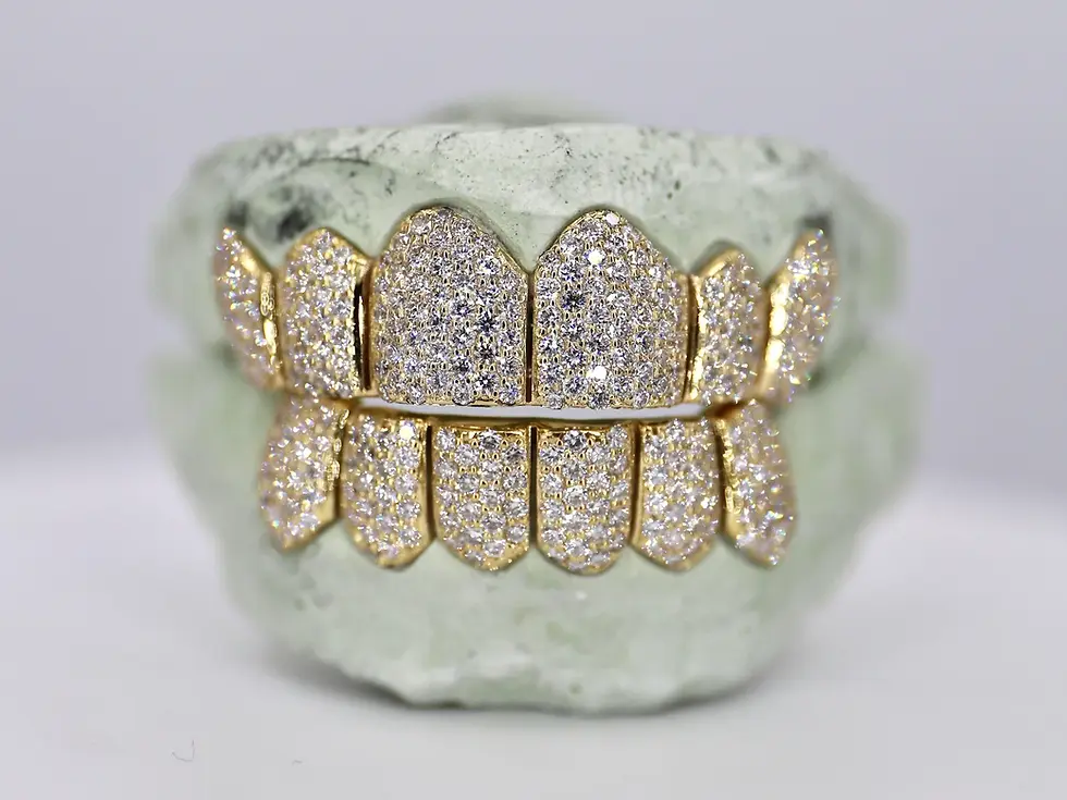 Thumbnail: 6 ON 6 VVS MOISSANITE DIAMOND GRILLZ