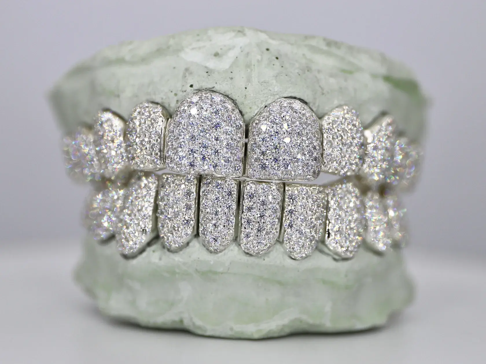 CUSTOM MOISSANITE DIAMOND GRILLZ