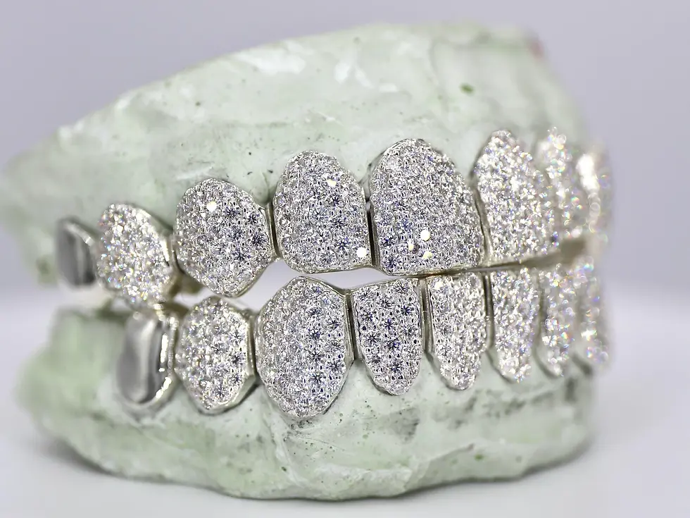 Thumbnail: 10 ON 10 CAPPED VVS MOISANNITE DIAMOND GRILLZ