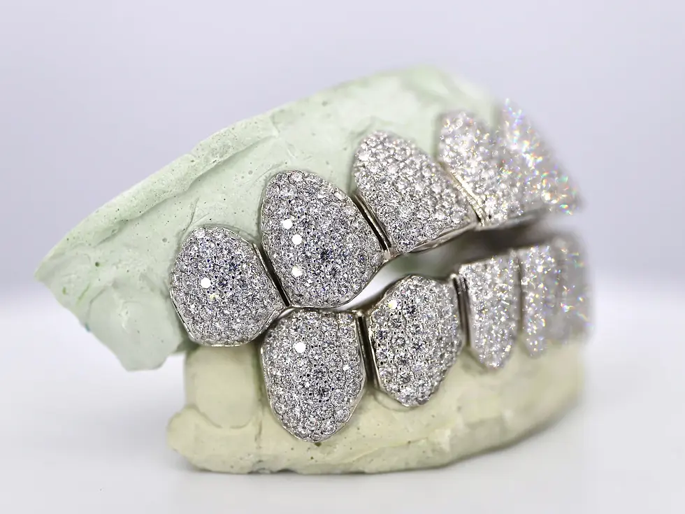 Thumbnail: VVS LAB DIAMOND GRILLZ