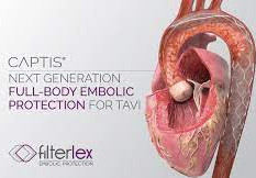Cardiovascular startup Filterlex Medical receives €7M from the European Innovation Council