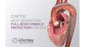 Cardiovascular startup Filterlex Medical receives €7M from the European Innovation Council