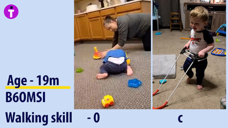 Separate and Unequal Independent Walking Standards for Blind Toddlers