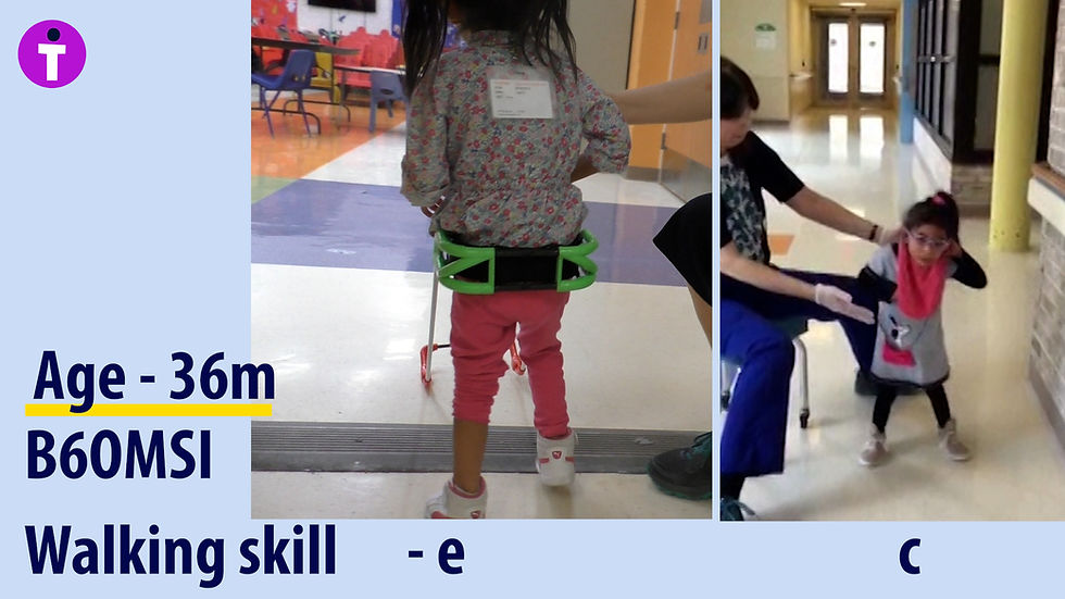 Age - 36m B60MSI Walking Skill - under the picture of the 3-year-old girl walking in her school over a large threshold wearing belt cane letter "e" and under the picture of the same girl walking independently without a belt cane the letter "c".