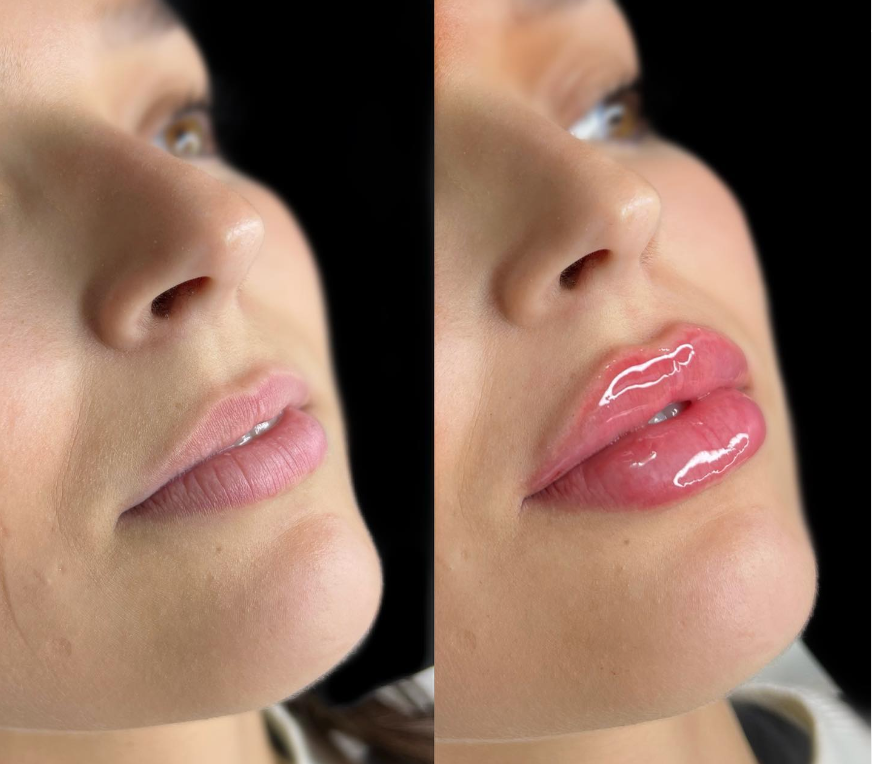 labios 