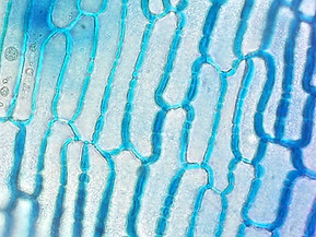 Araucaria40xbot_23_edited.jpg