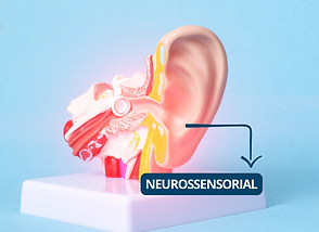 perda auditiva neurossensorial.png