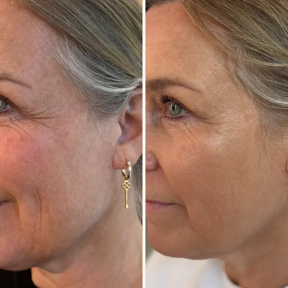 Before after minimal skincare Instagram post_result_1.webp